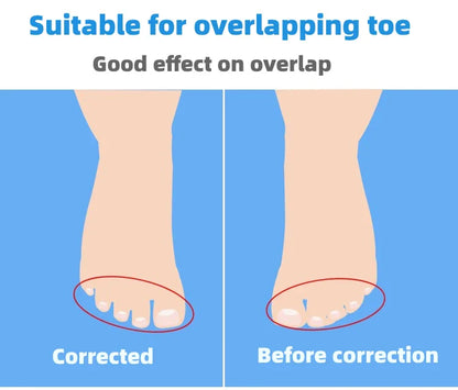 4pcs=2pairs Child Silicone Gel Foot Finger Toe Separator Thumb Protector Bunion Adjuster Hallux Valgus Pedicure For Kid
