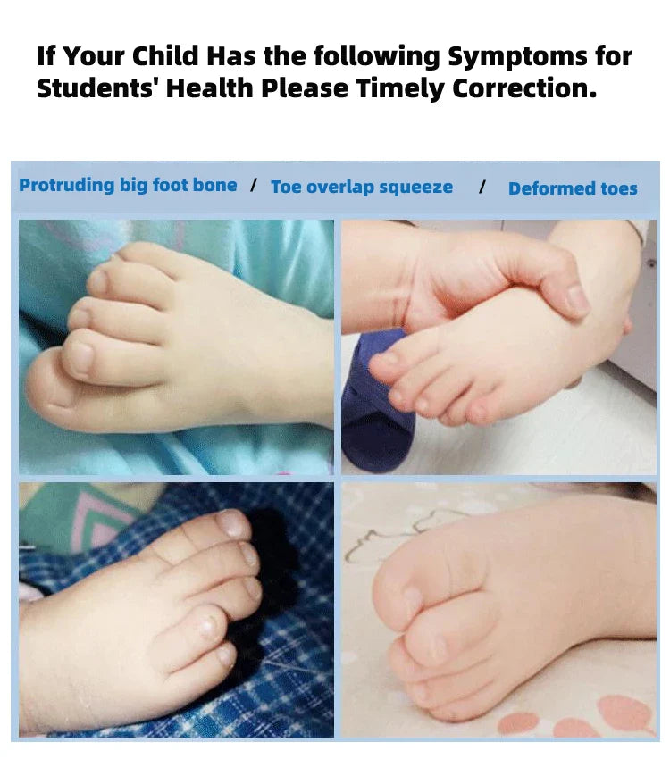 4pcs=2pairs Child Silicone Gel Foot Finger Toe Separator Thumb Protector Bunion Adjuster Hallux Valgus Pedicure For Kid