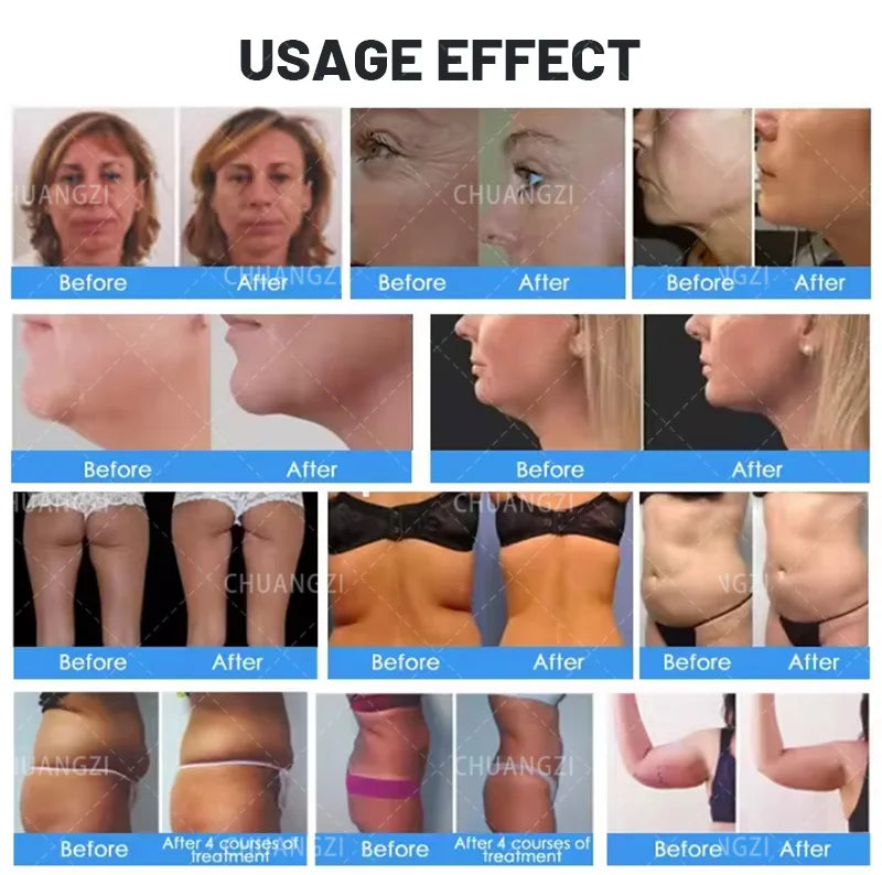 2 in 1 RF ULTRA 360 Body Contouring Cellulite Reduction Face Skin Rejuvenation Tightening Beauty Machine .