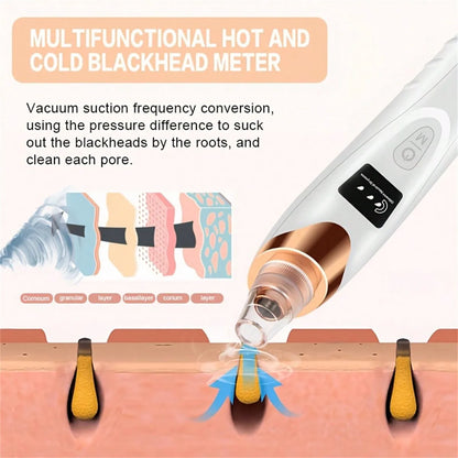 5 Suction Power Blackhead Remover Pore Vacuum,Women Blackhead Remover Pore Vacuum,FacialPoreCleaner Kit For Adult ExtractorTool