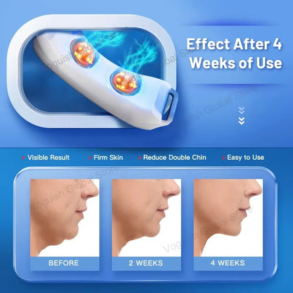 Double Chin Remover Ems Face Lifting Massager Anti Wrinkle Firming Facial Massager V-Face Lift Device Skin Care