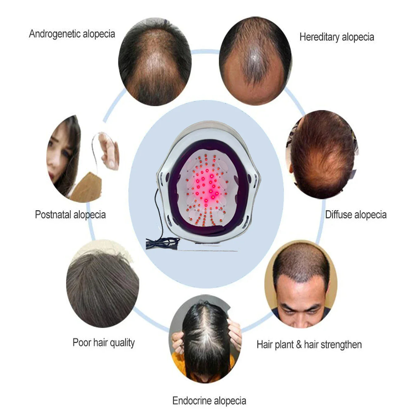 LLLT low leve laser 650nm hair loss products