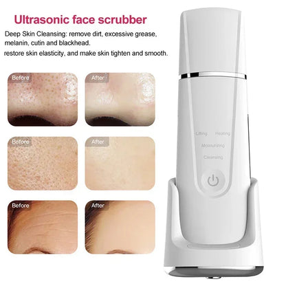 Electric Ultrasonic Skin Deep Cleaning Peeling Shovel Ultrasonic Cleaner Beauty Machine Facial Skin Care Face Lifting Machine
