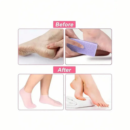 1 Pair Suitable Women Dry Cracked Feet Silicone Socks Available Multiple Colors for Moisturizing Cracked Feet