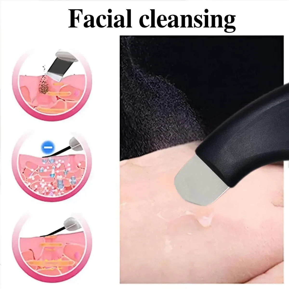 Manual acne extractor, capable of cleaning the skin of the nose and face, beauty care tool