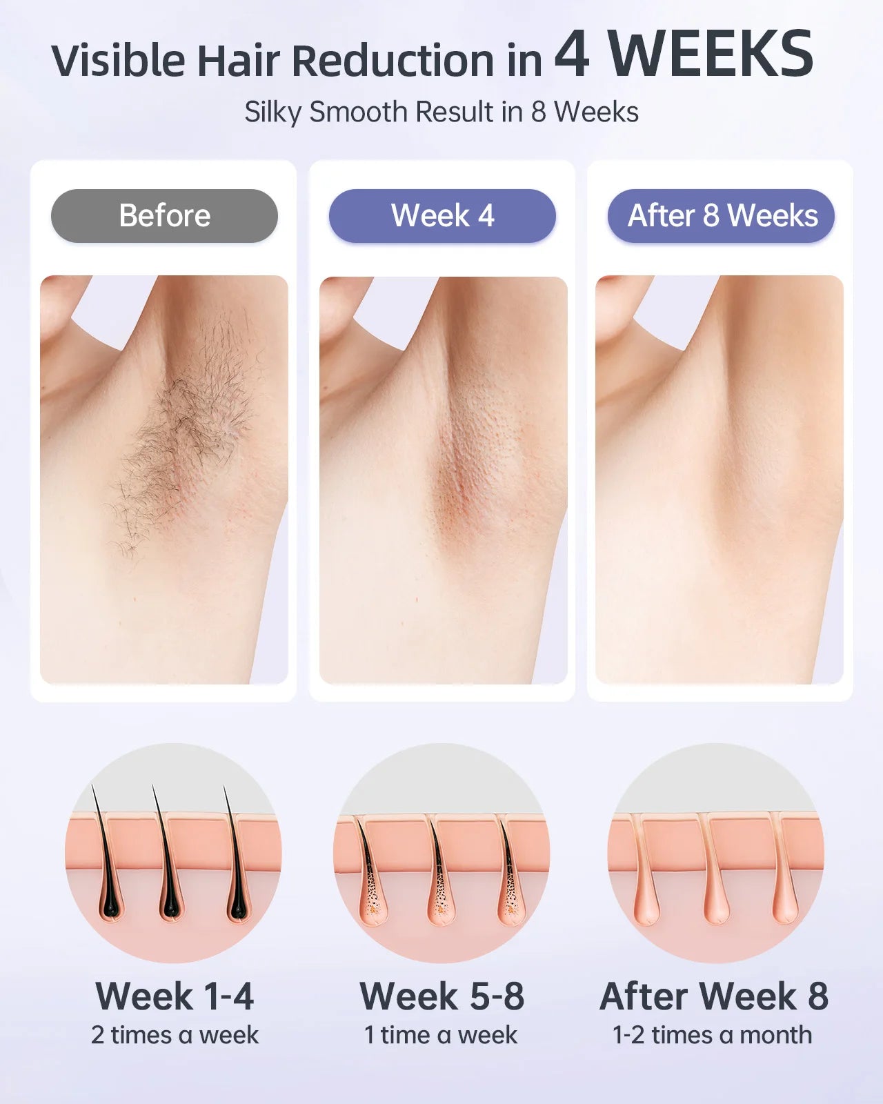 Laser Hair Removal 999999+ Flashes IPL Device with Long-Lasting in Hair Reduction for Body&Face Safe at-home Results in 4 Weeks