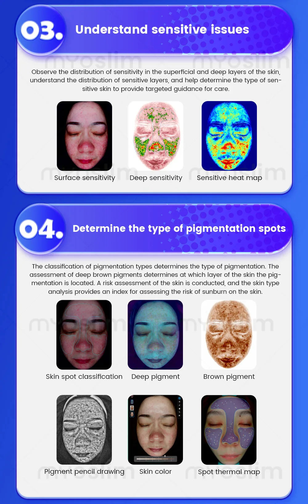 Salon-Grade Skin Analyzer Camera Multispectral imaging- 36MP HD Facial Skin Detection for Acne/Aging/Pigmentation Skin Care