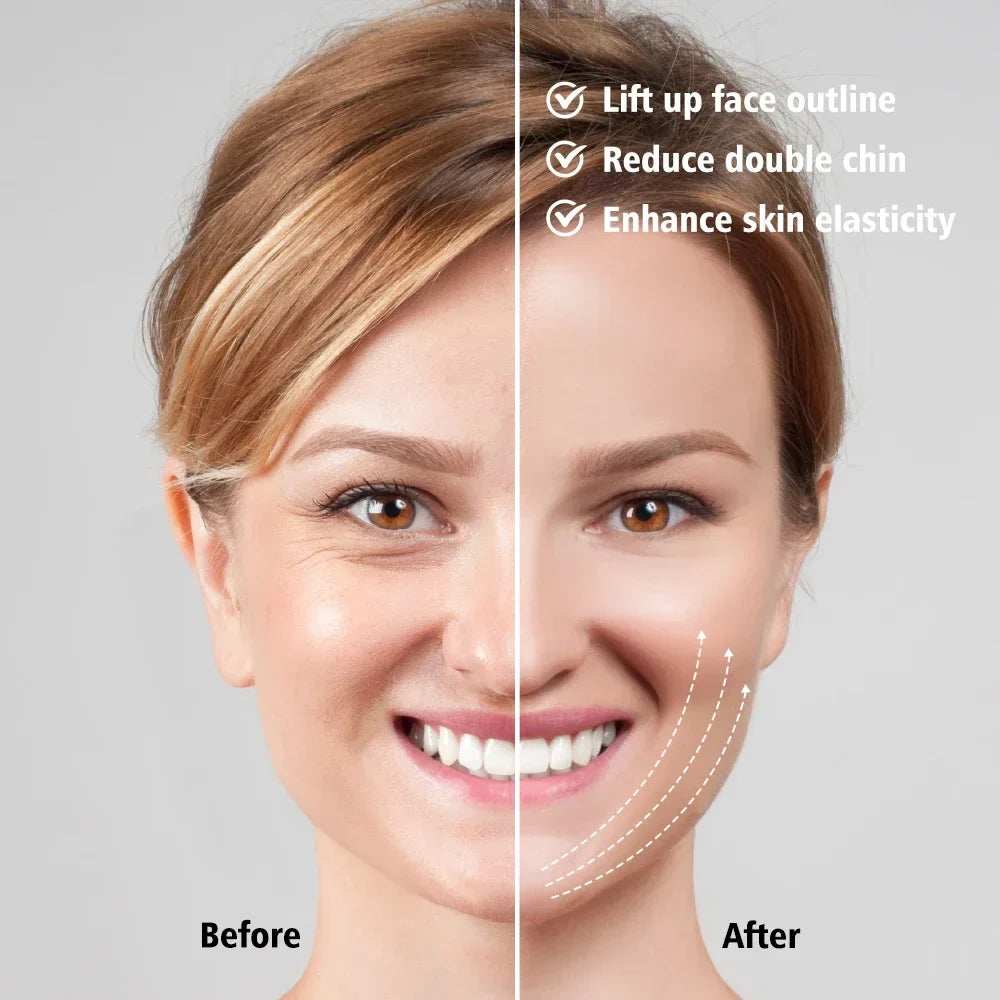 Double Chin Remover Ems Face Lifting Massager Anti Wrinkle Firming Facial Massager V-Face Lift Device Skin Care