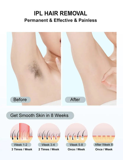 IPL Hair Removal Device 990000 Flashes for Women Painless Permanent Laser Epilator for Body Bikini and Facial Hair Home Use