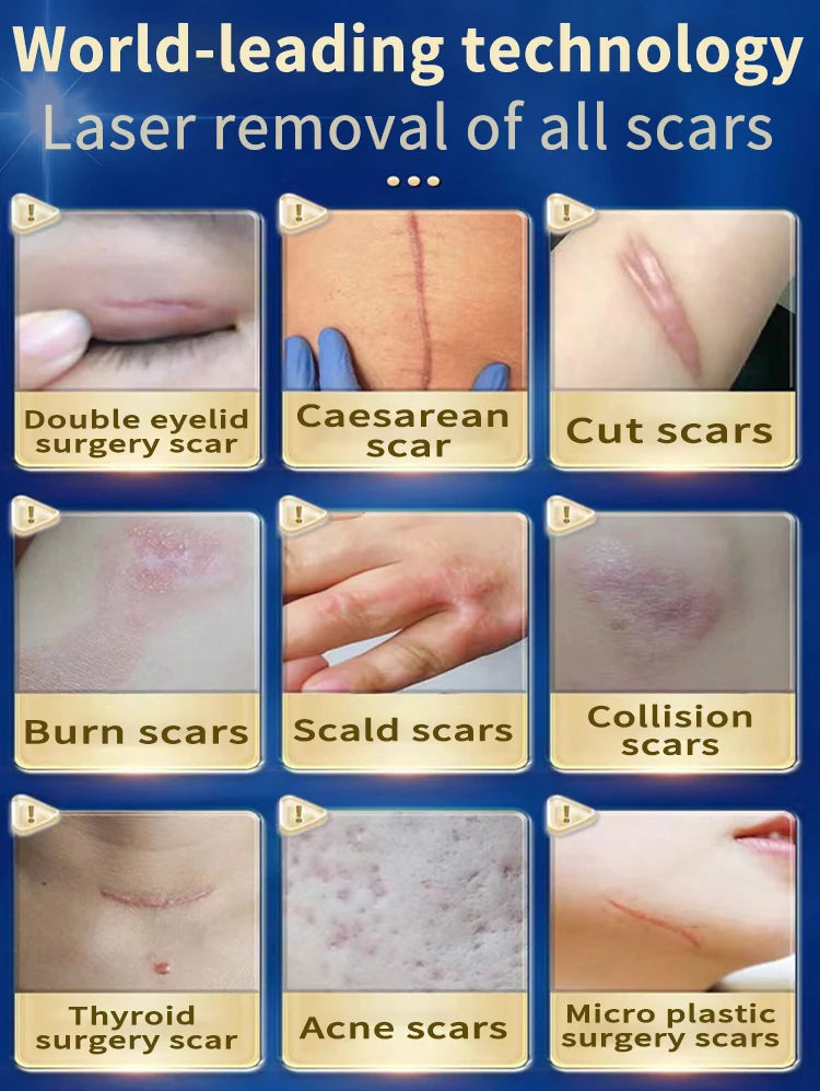 The latest scar removal technology, remove scars in 7 days, best-selling product in Asia