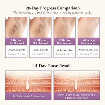 Malay Laser MLAY T14 IPL Ice Cool Laser Hair Removal Device Original Hair Removal Replaceable Lamps Home Epilator For Men Women