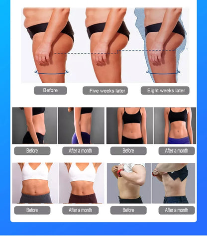 Myoslim NEO 15T RF 6500W Myoslim Machine - Advanced Body Sculpting & Fat Burning Technology