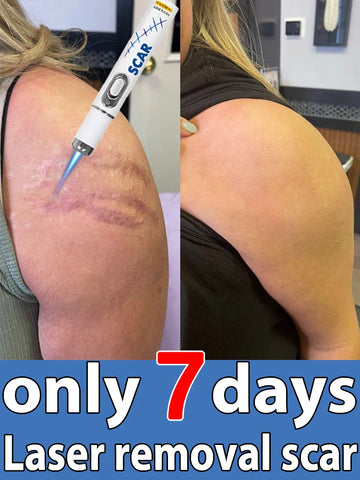 The latest scar removal technology, remove scars in 7 days, best-selling product in Asia