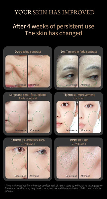 Radiofrequency facial tightening device - Skin tightening and lifting radiofrequency high-frequency facial care massage equipmen