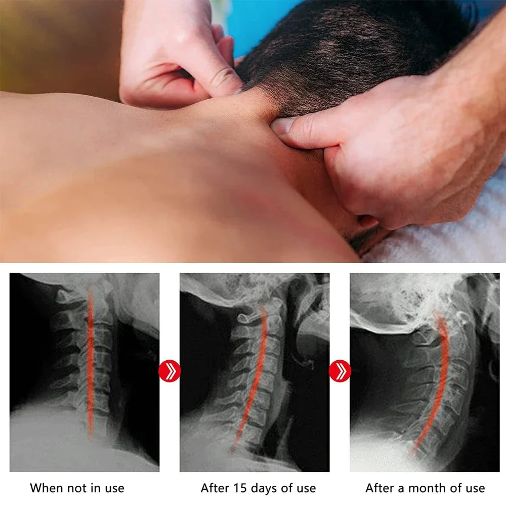 Neck and Shoulder Relaxer with Upper Back Massage Point, Cervical Traction Device Neck Stretcher for TMJ Pain Relief and Spine