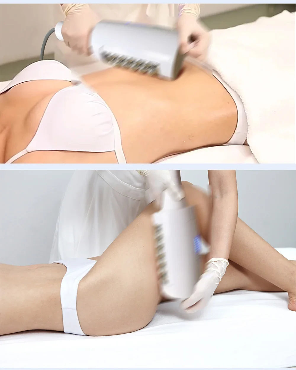 Myoslim NEO 15T RF 6500W Myoslim Machine - Advanced Body Sculpting & Fat Burning Technology