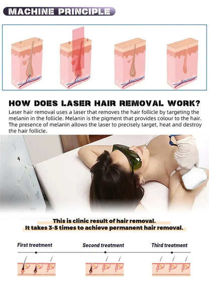 Professional Diode Ice Titanium Laser Hair Removal Machine Portable 808 755 1064 Alexandrite Device 3 Waves Permanent Removal