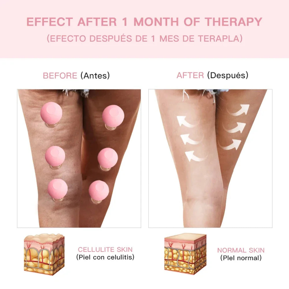 Facial Silicone Cans Cupping Cups Lifting Massage Chinese Cupping Set Small Mini Eye Cup Vacuum Cups Popularity Health Care