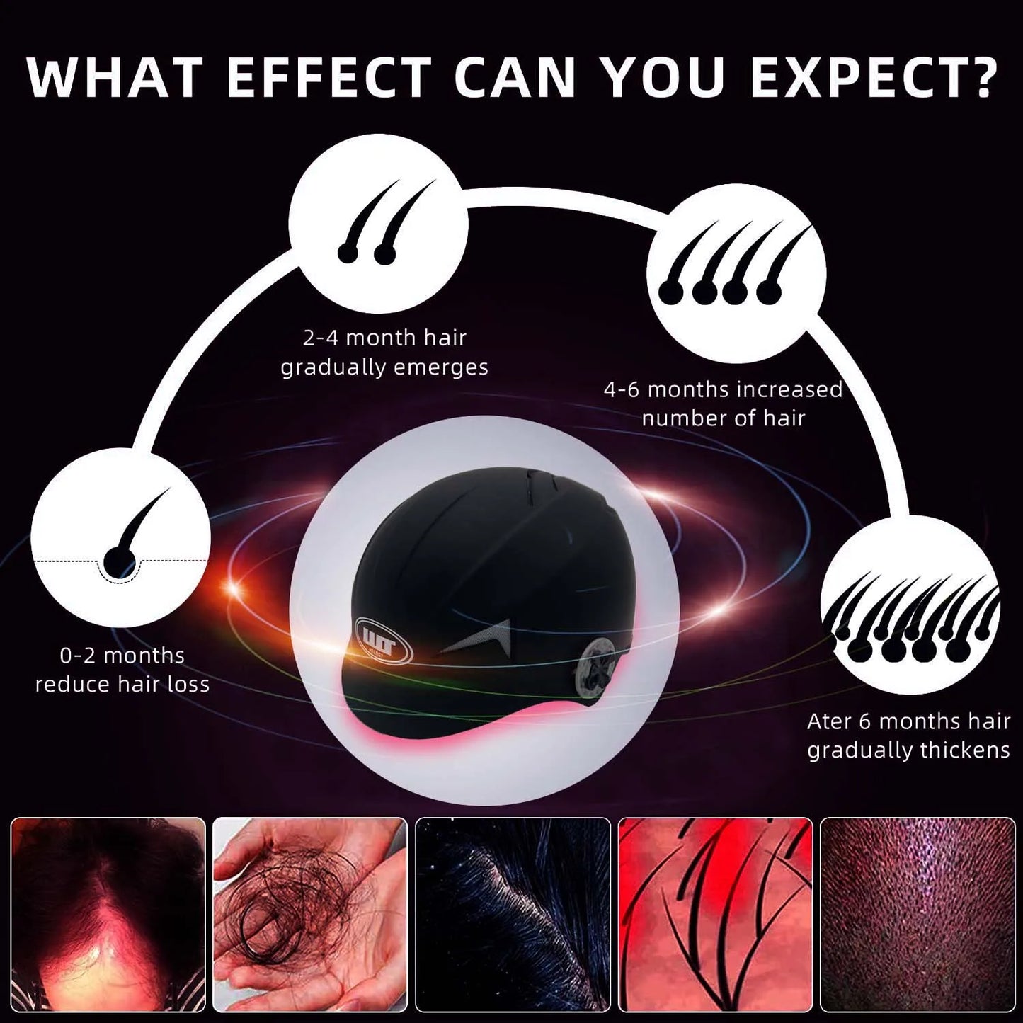 LLLT low leve laser 650nm hair loss products