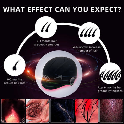 LLLT low leve laser 650nm hair loss products