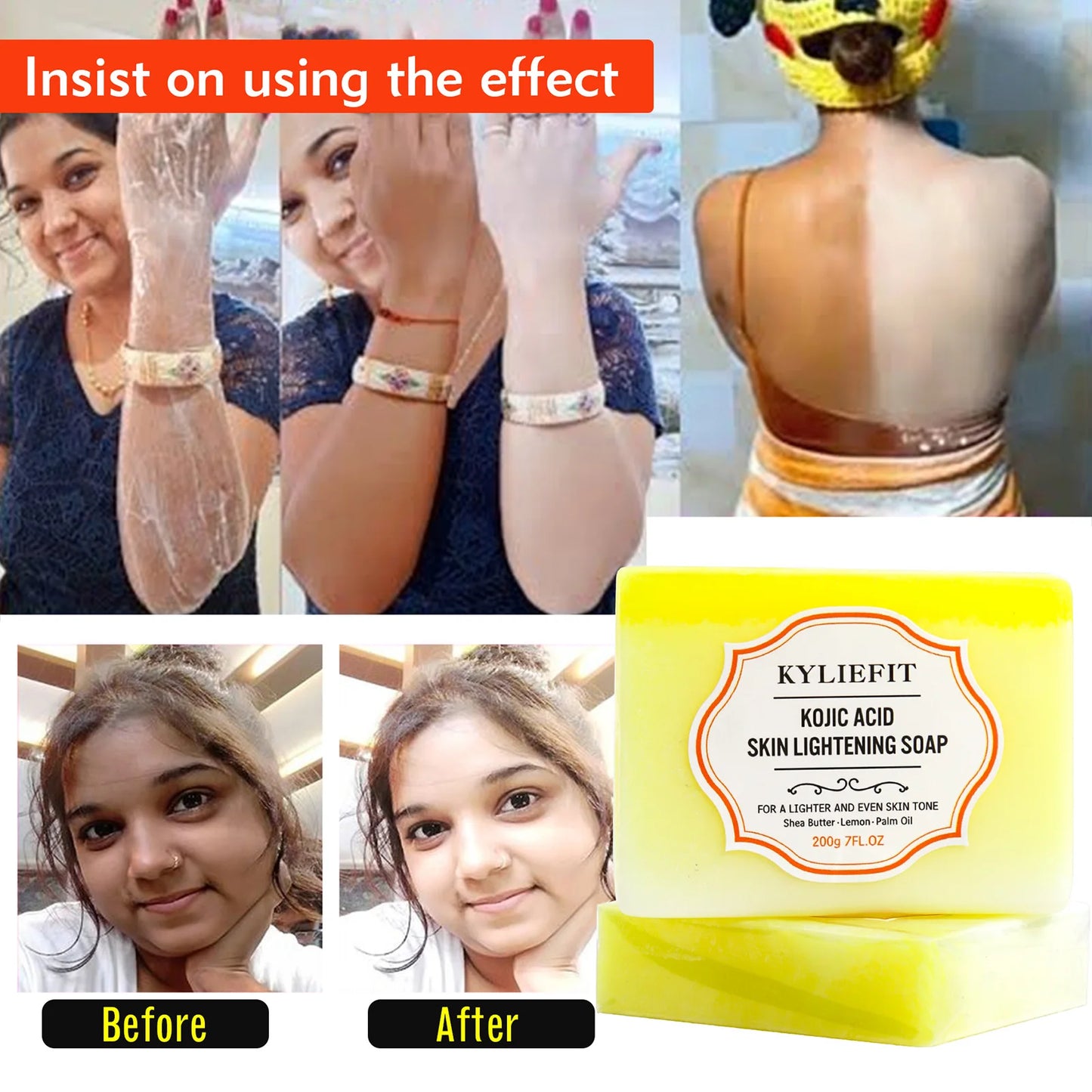 Kojic Acid Whitening & Dark Spot Remover Soap Bar, with Turmeric, Shea Butter, Coconut Oil, Lightening & Clean Skin, 200g/7 oz