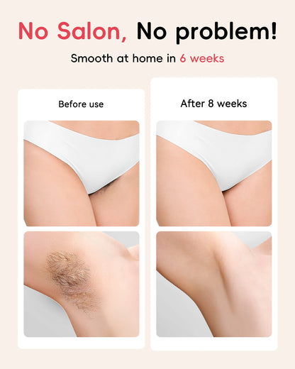 Professional IPL Hair Removal 22J Unlimted Flashes Painless Laser Epilator  Armpits Legs Arms Bikini Line Treament Home Use