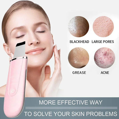 Electric Ultrasonic Skin Deep Cleaning Peeling Shovel Ultrasonic Cleaner Beauty Machine Facial Skin Care Face Lifting Machine