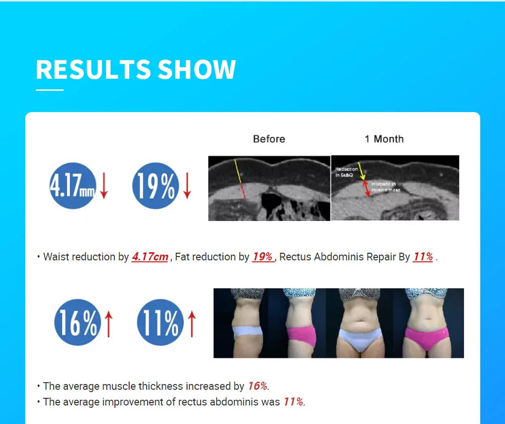 Myoslim NEO 15T RF 6500W Myoslim Machine - Advanced Body Sculpting & Fat Burning Technology
