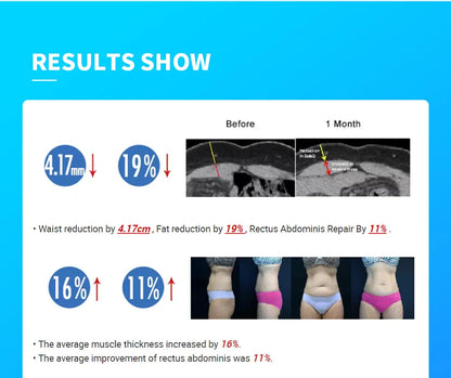 Myoslim NEO 15T RF 6500W Myoslim Machine - Advanced Body Sculpting & Fat Burning Technology