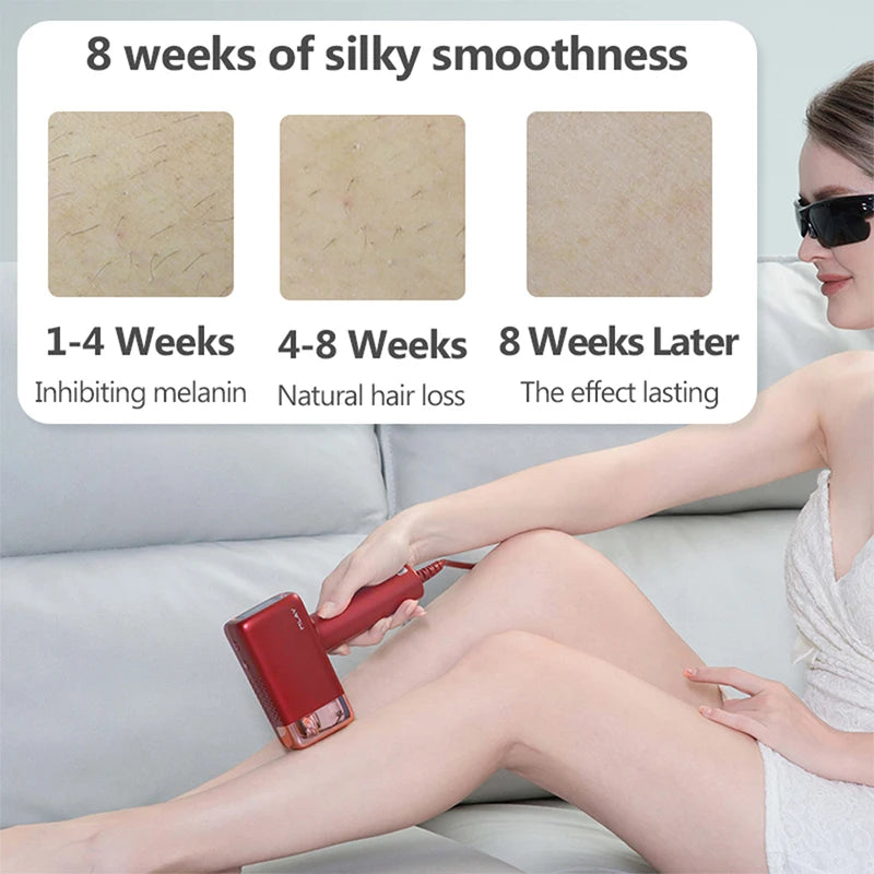MLAY T14 IPL Hair Removal ICE Cool Laser Hair Removal Epilator 3IN1 Permanent Epilator Body 500000 Flashes Electric Depilator
