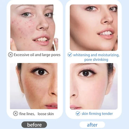 Portable RF Microcurrent Beauty Machine Lift Saggy Skin Brighten Dullness Hydrate Facial Moisturizing Equipment for Glowing Face