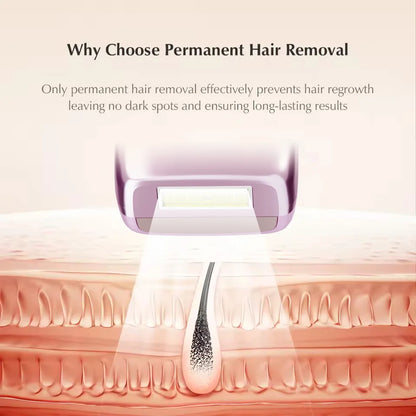 Malay Laser MLAY T14 IPL Ice Cool Laser Hair Removal Device Original Hair Removal Replaceable Lamps Home Epilator For Men Women