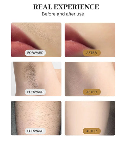 Professional Diode Ice Titanium Laser Hair Removal Machine Portable 808 755 1064 Alexandrite Device 3 Waves Permanent Removal