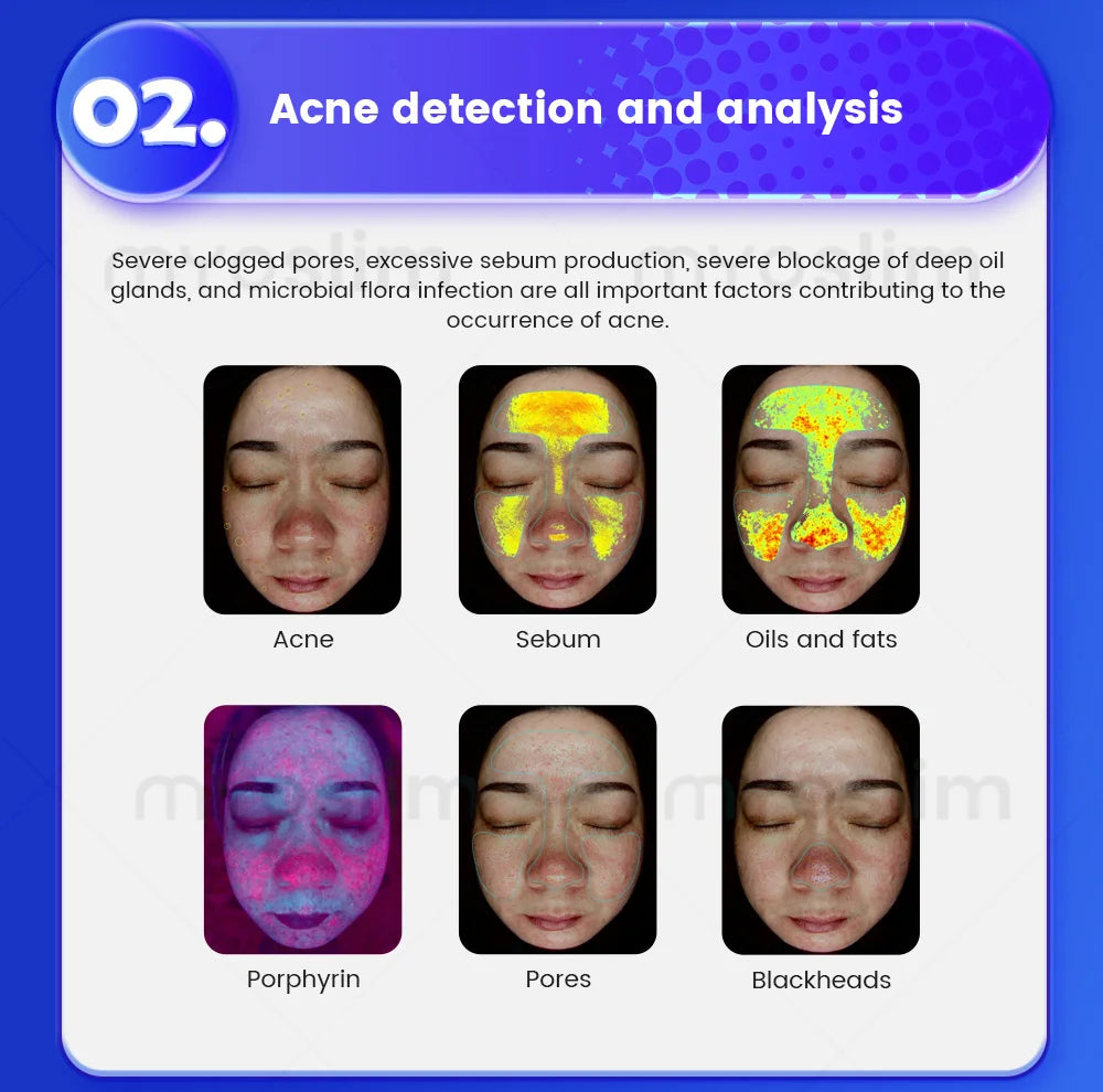 Salon-Grade Skin Analyzer Camera Multispectral imaging- 36MP HD Facial Skin Detection for Acne/Aging/Pigmentation Skin Care